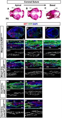 Lineage-specific mutation of Lmx1b provides new insights into distinct regulation of suture development in different areas of the calvaria